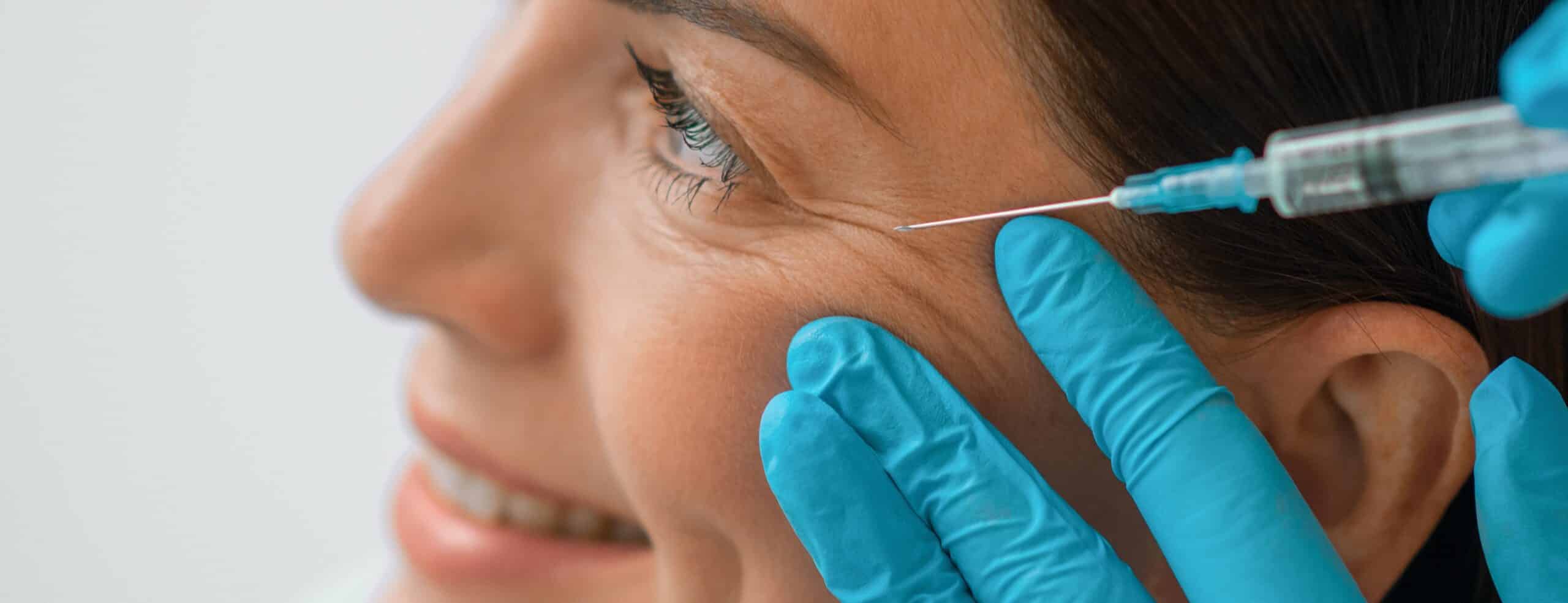 Au bout de combien de temps les effets du botox s’estompent-ils ?