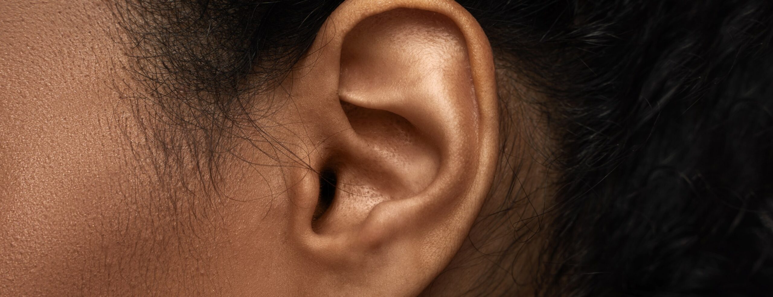 Pourquoi a-t-on les oreilles décollées ?