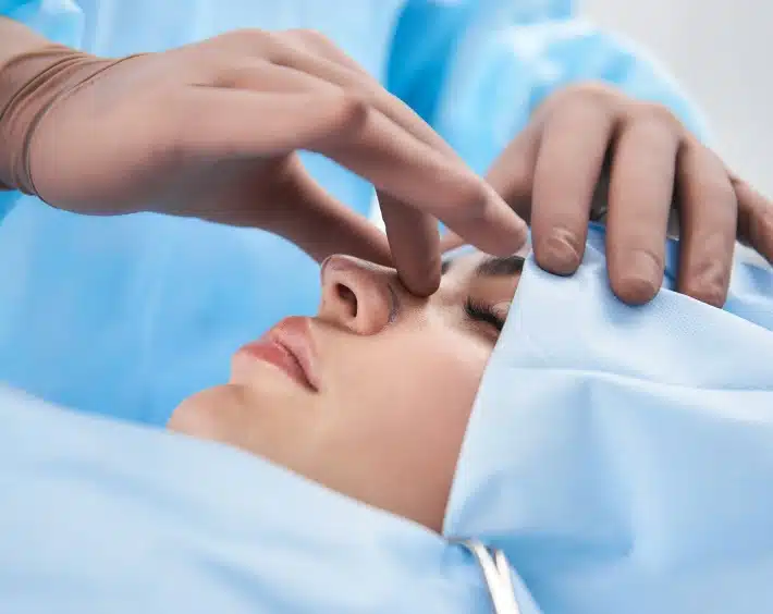 rhinoplastie avant / apres