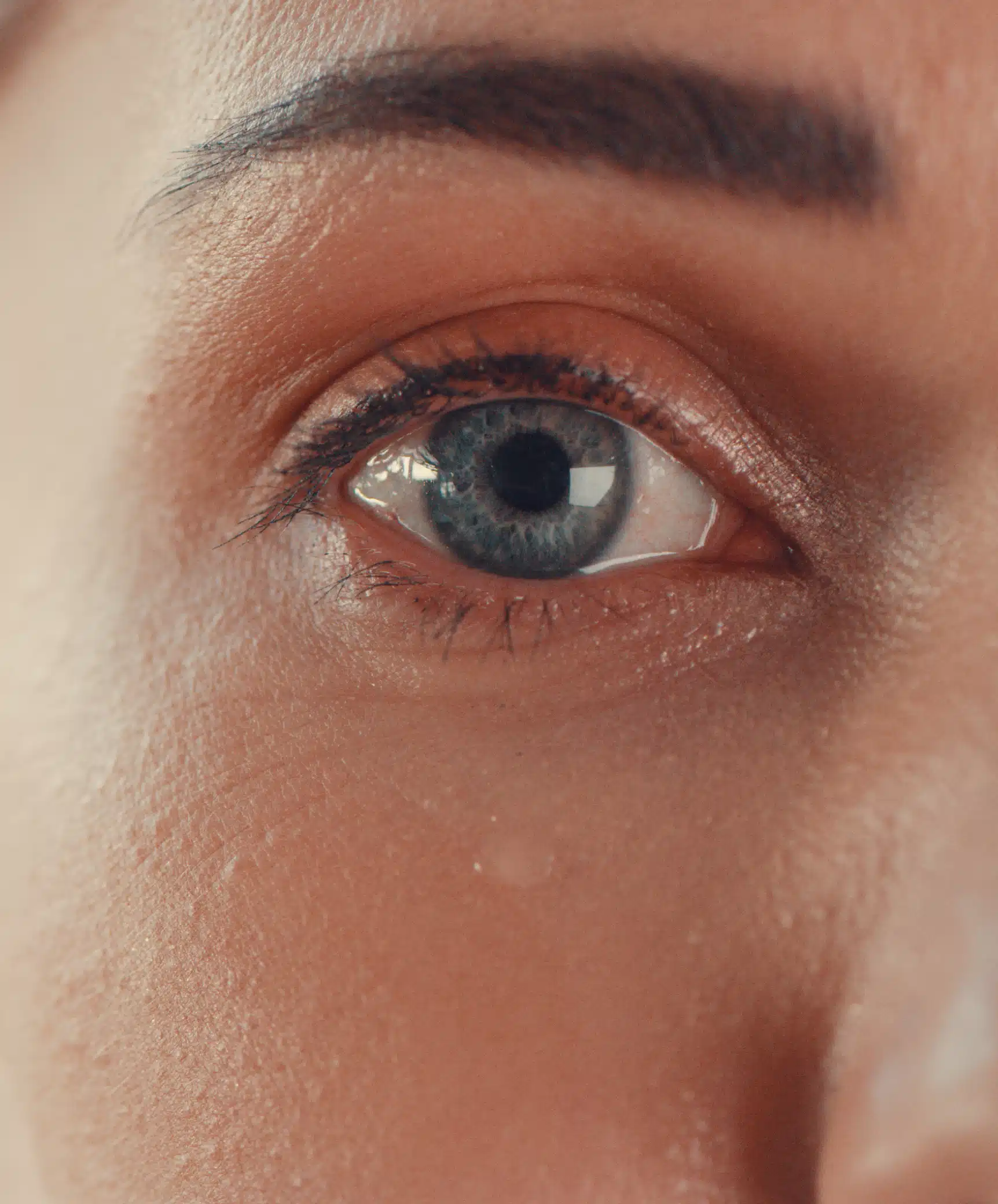 Injection acide hyaluronique pour cernes quoi attendre | Dr Durbec | Lyon