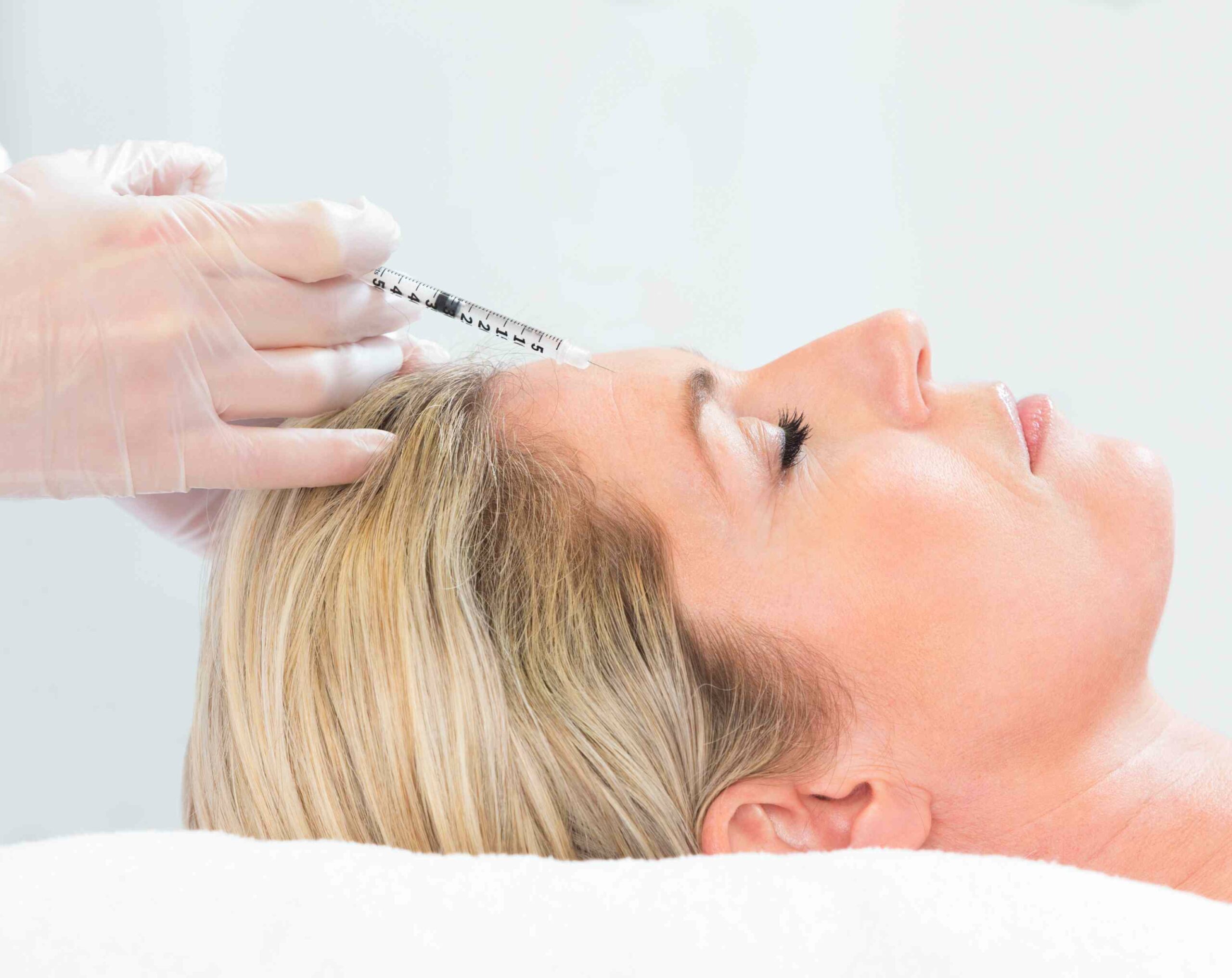 À partir de quel âge peut-on débuter les injections de botox ? | Dr Durbec | Lyon