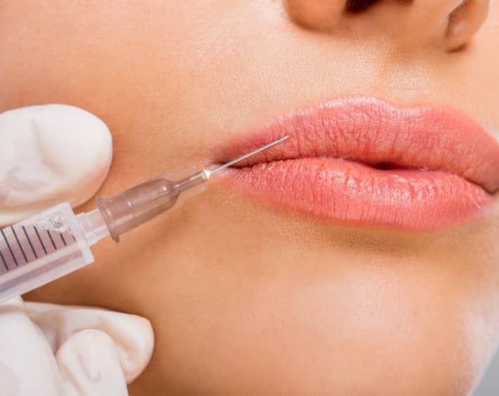 Peut-on redonner du volume à des lèvres trop fines ? | Dr Durbec | Lyon