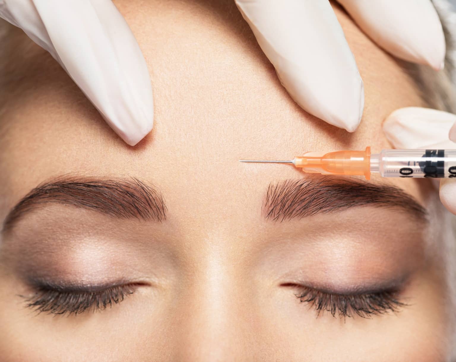 Quand apparaissent les effets d’une injection de botox ? | Dr Durbec | Lyon