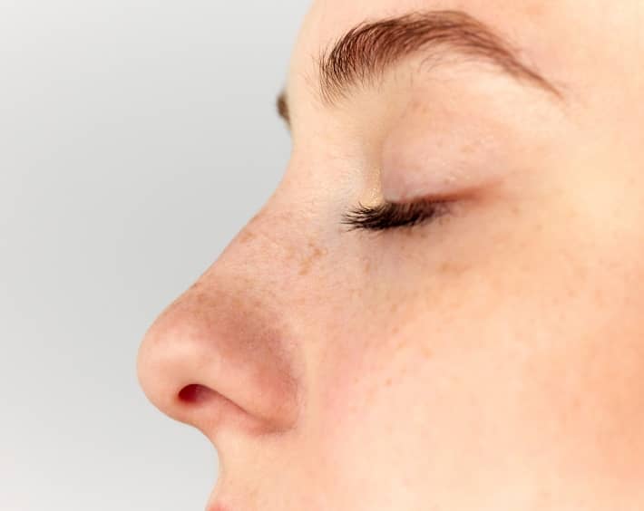 Comment vieillit un nez refait ? | Dr Durbec | Lyon