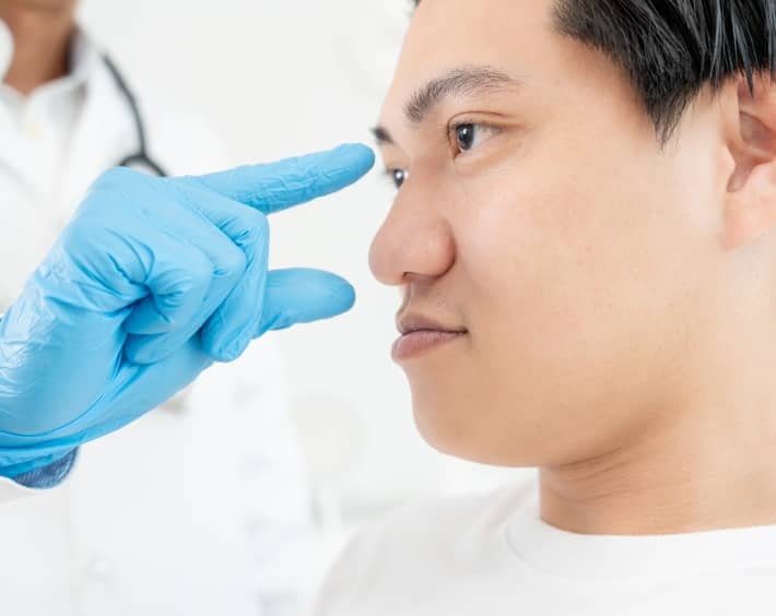 La rhinoplastie chez l’homme | Dr Durbec | Lyon