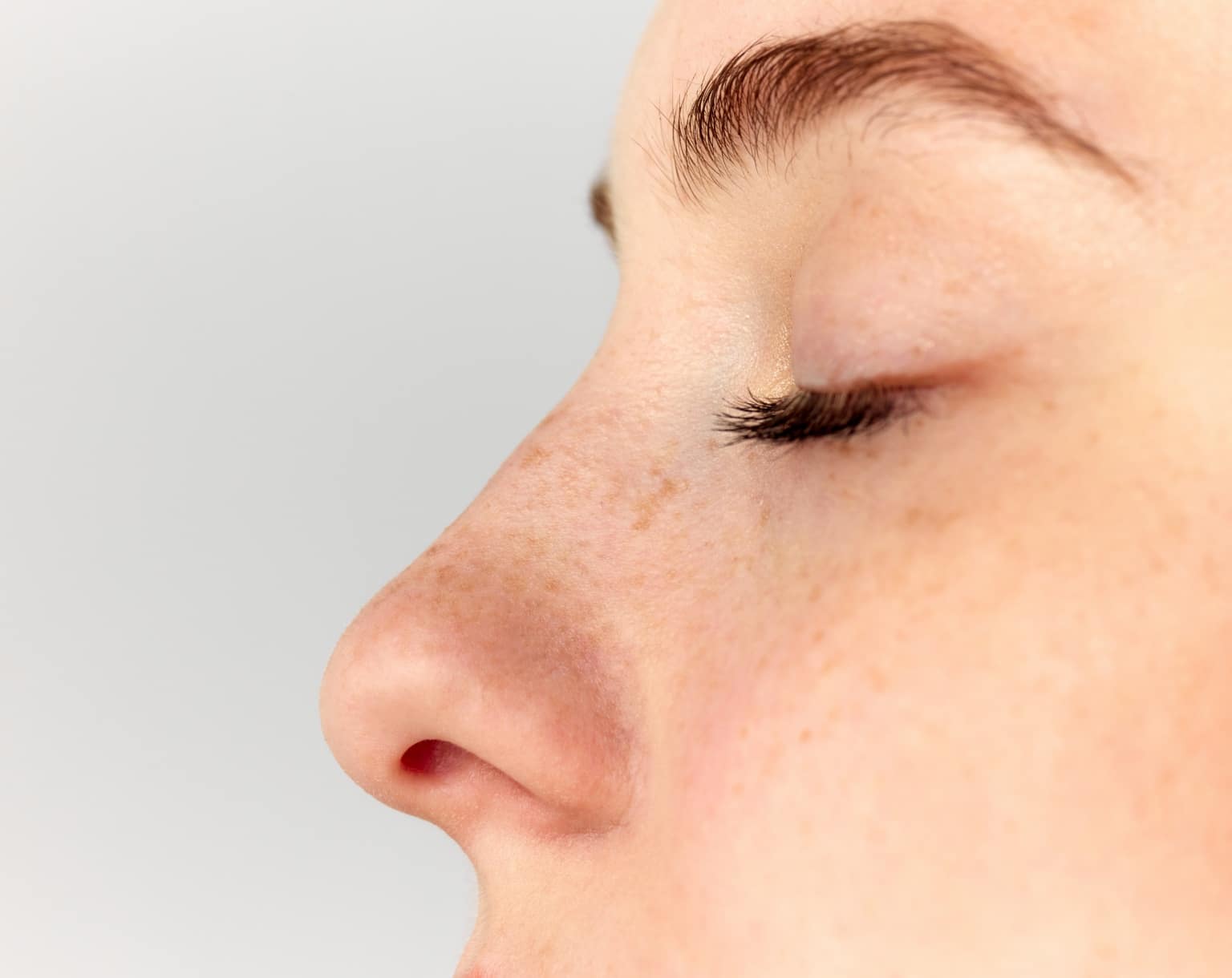 rhinoplastie ouverte ou fermée